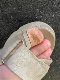 みゆ・陥入爪って知ってる？