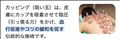 閲覧注意(カッピング)